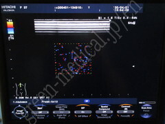 Hitachi Ultrasound Color Doppler