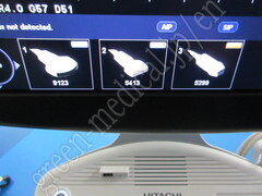 Hitachi Ultrasound Color Doppler