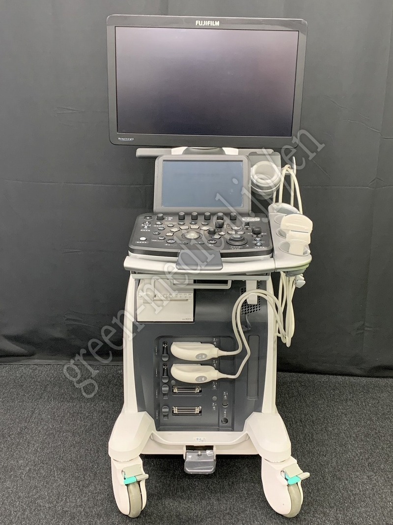 0.◯超音波診断装置(カラードプラ)