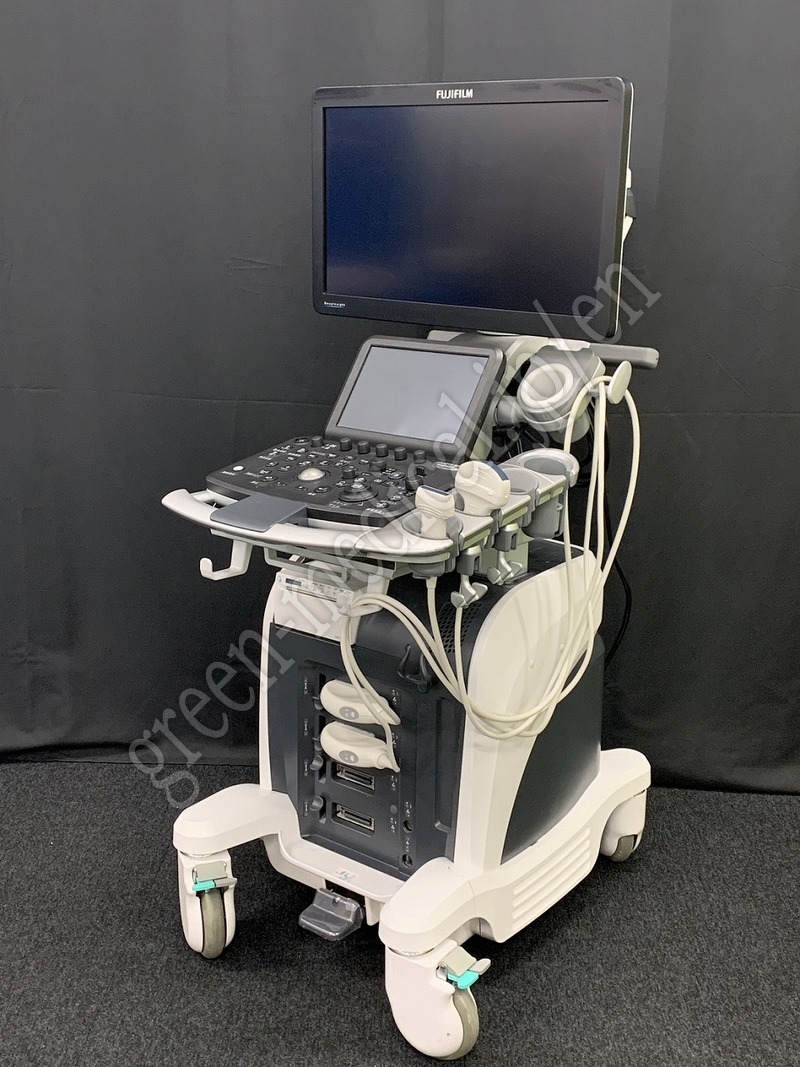 1.◯超音波診断装置(カラードプラ)