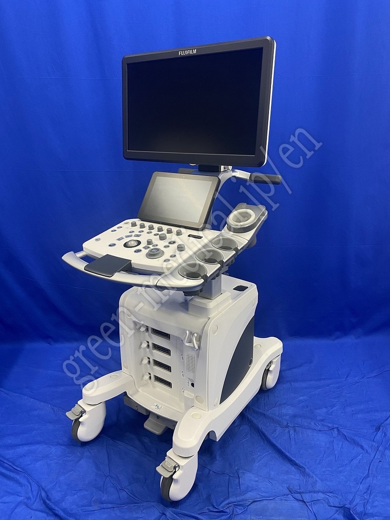 1.○超音波診断装置(カラードプラ)