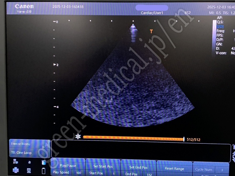 10.〇 超音波診断装置