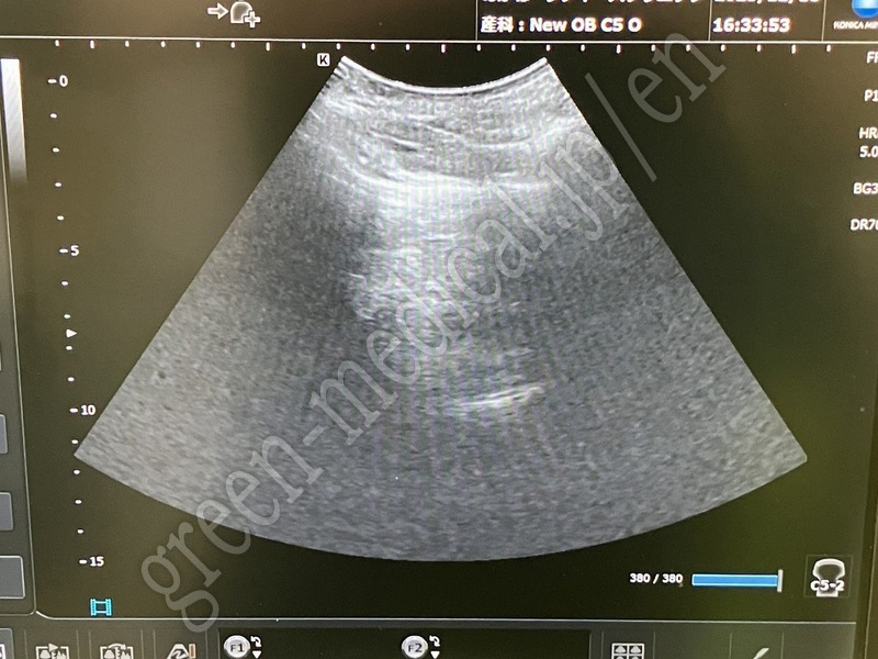 10.○ 超音波診断装置（カラー）