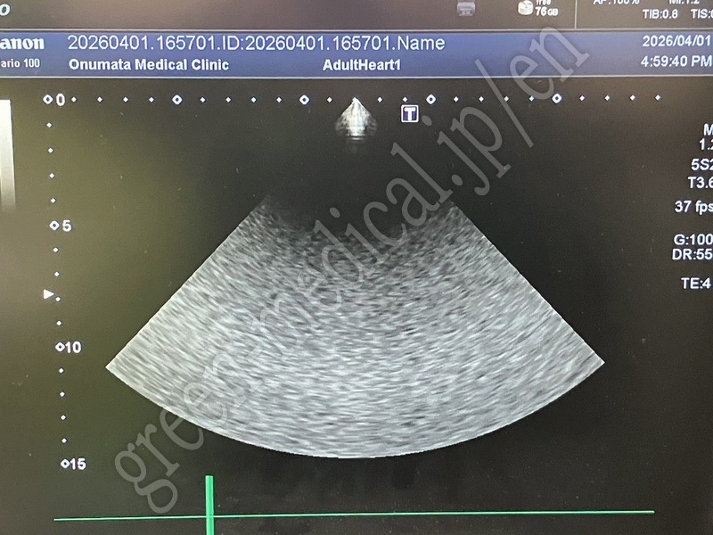 10.○超音波診断装置 ＜プローブ3本構成＞