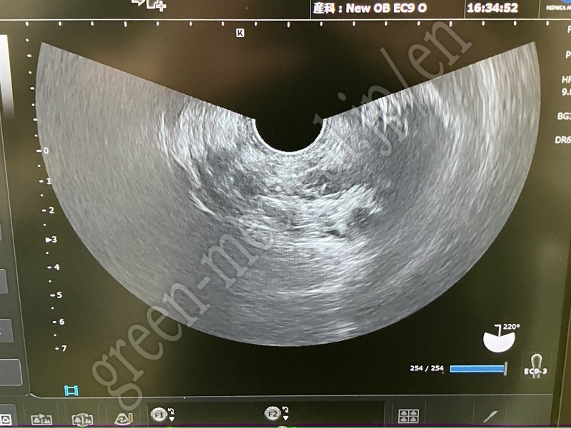 11.○ 超音波診断装置（カラー）