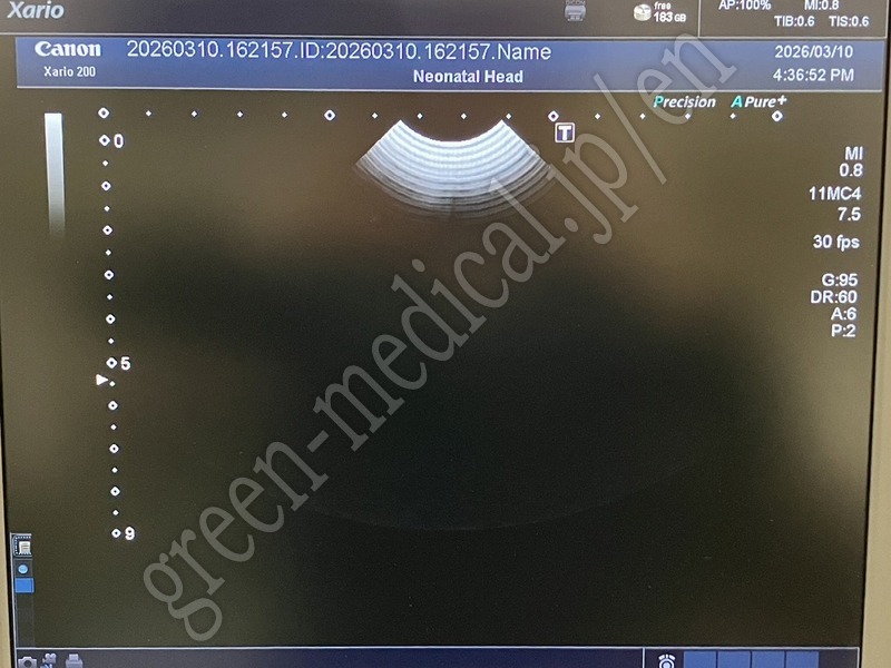 11.○ 超音波診断装置【動物病院専用】