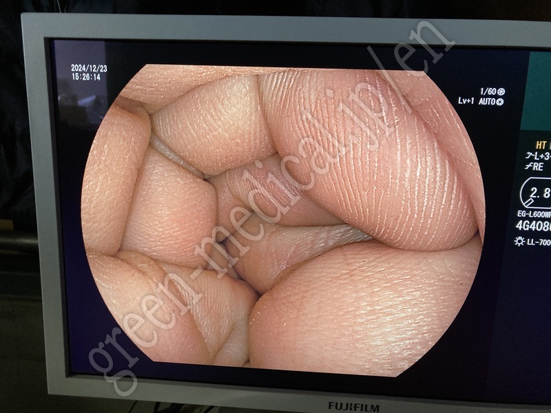 12.○ 上部消化管用汎用スコープ