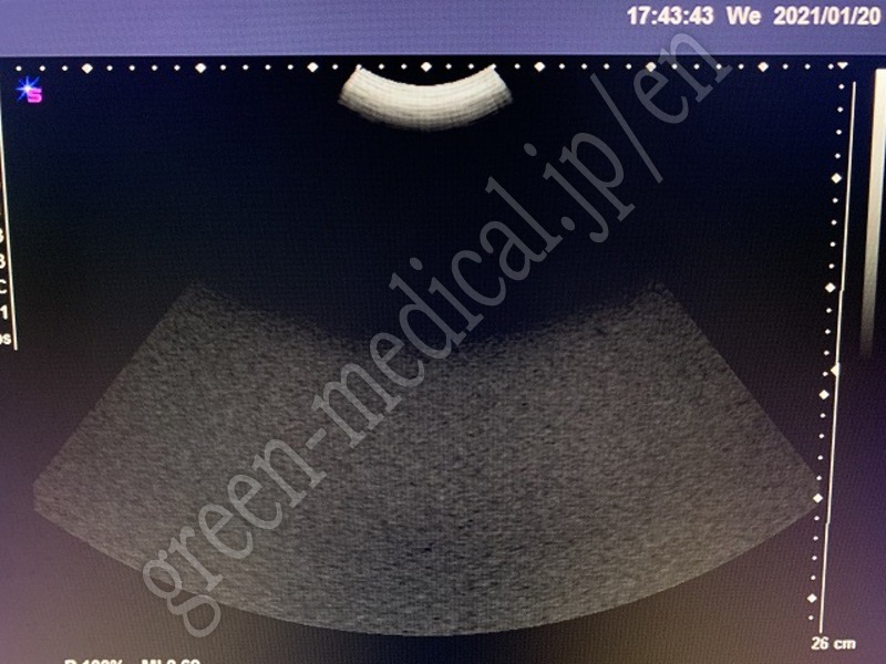 13.〇超音波診断装置（カラー）