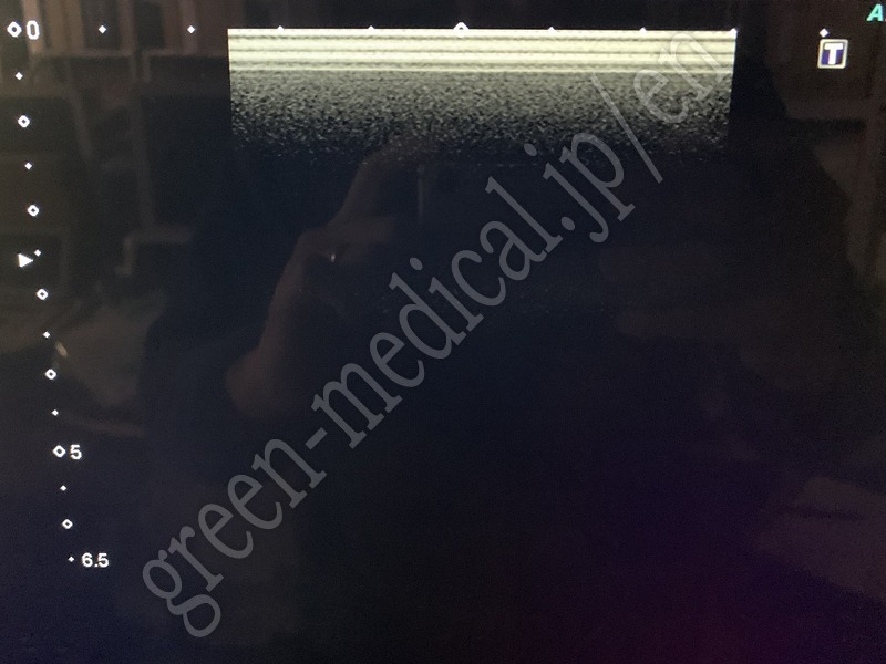 19.○ 超音波診断装置