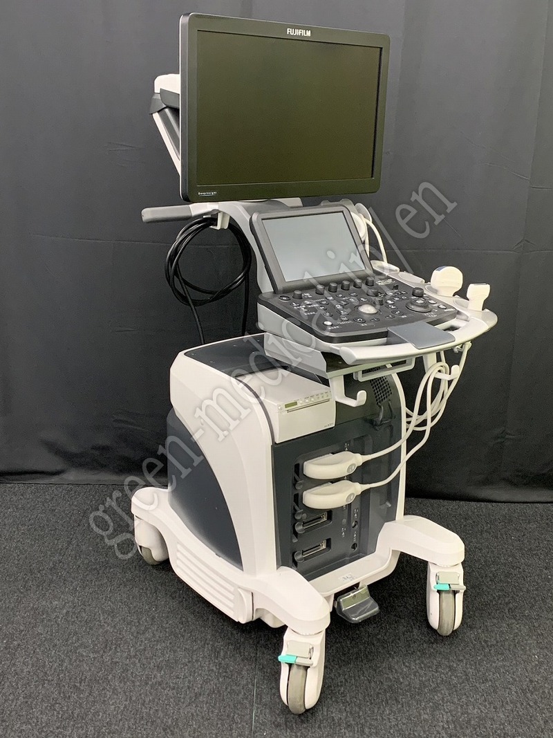 2.◯超音波診断装置(カラードプラ)