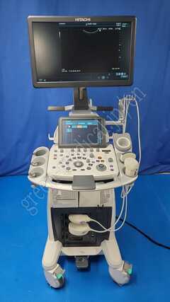 Diagnostic Ultrasound Scanner
