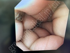 OLYMPUS Video Gastroscope