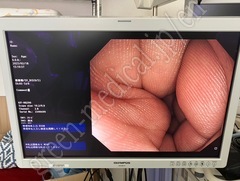 Video Gastroscope