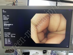 Video Colonoscope