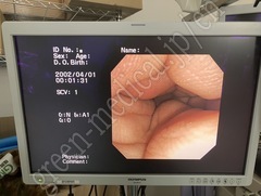 OLYMPUS Video Transnasal Gastroscope