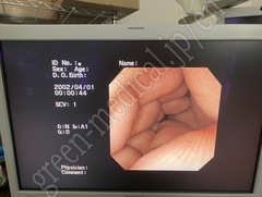 OLYMPUS Video Transnasal Gastroscope