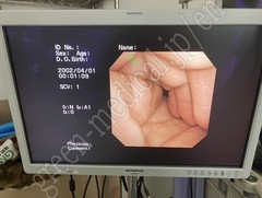 OLYMPUS Video Bronchoscope