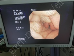 OLYMPUS Video Bronchoscope