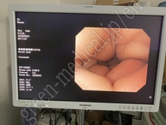 Video Gastroscope