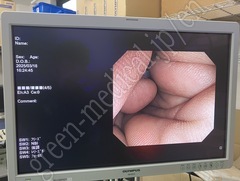 OLYMPUS Video Colonoscope
