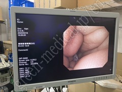 OLYMPUS Video Gastroscope