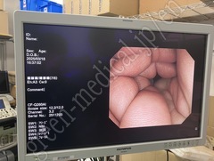 OLYMPUS Video Colonoscope