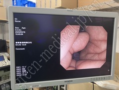 OLYMPUS Video Colonoscope