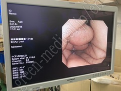 OLYMPUS Video Colonosope