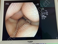 FUJIFILM Video Transnasal Gastroscope
