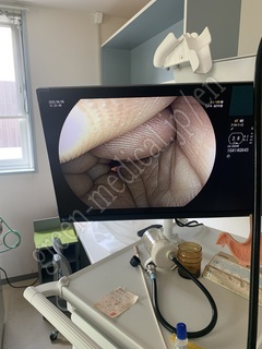 Video Gastroscope