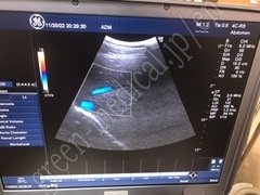 GE Healthcare Convex Probe