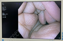 OLYMPUS Video Gastroscope
