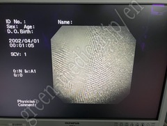 OLYMPUS Video Bronchoscope