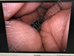 OLYMPUS High Definition LCD monitor