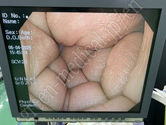 OLYMPUS High Definition Monitor