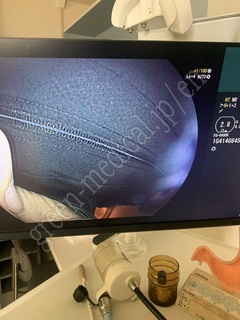 FUJIFILM Video Gastroscope