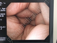 OLYMPUS High Definition Monitor