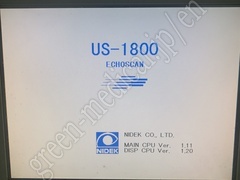 NIDEK Ophthalmic Ultrasound (A-Scan)