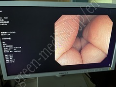 OLYMPUS Video Colonoscope