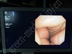 OLYMPUS Video Transnasal Gastroscope