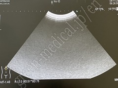 Hitachi Convex Probe (Arietta series)