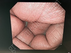 OLYMPUS High Definition LCD monitor