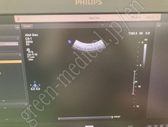 PHILIPS Convex Probe