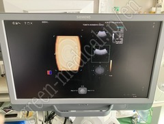 SIEMENS Color Doppler Ultrasound