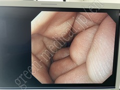OLYMPUS Video Gastroscope
