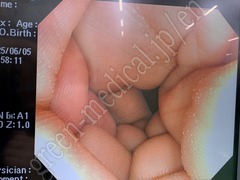 OLYMPUS High Definition Monitor