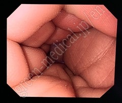 OLYMPUS High Definition LCD monitor