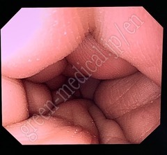 OLYMPUS High Definition LCD monitor