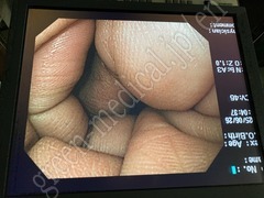 OLYMPUS LCD display
