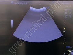 GE Healthcare XDclear Convex Transducer